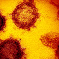 What is the Risk of Contracting COVID-19 from Surface Transmission?