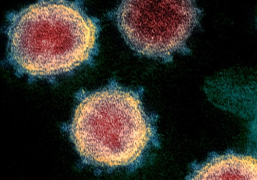 Can Covid-19 be Transmitted from Surfaces?